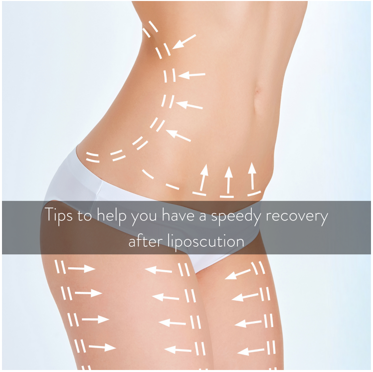 How to have a speedy recovery after liposuction