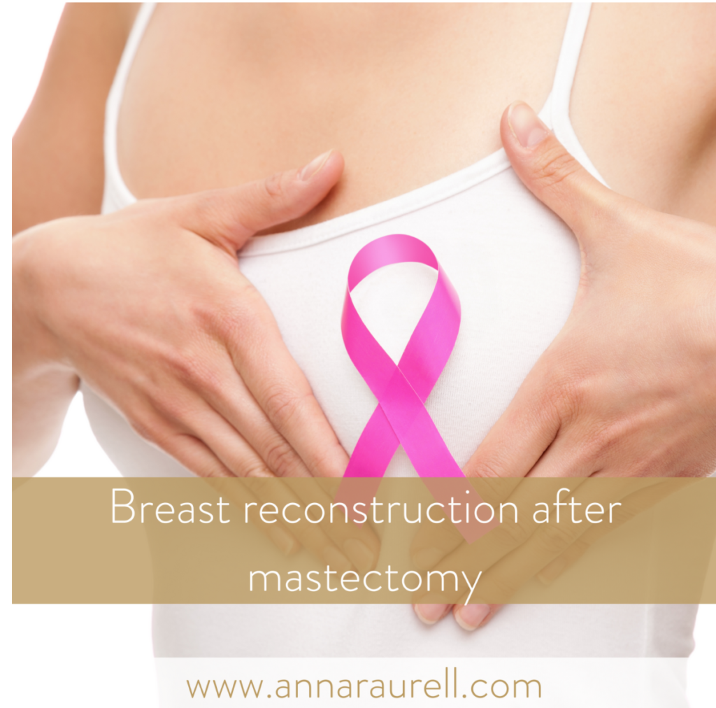 Breast reconstruction after a mastectomy