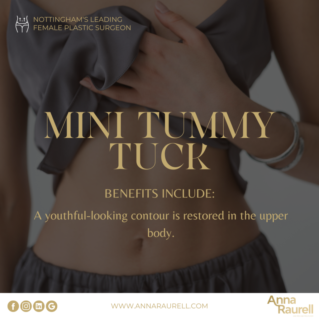 anna raurell mini tummy tuck