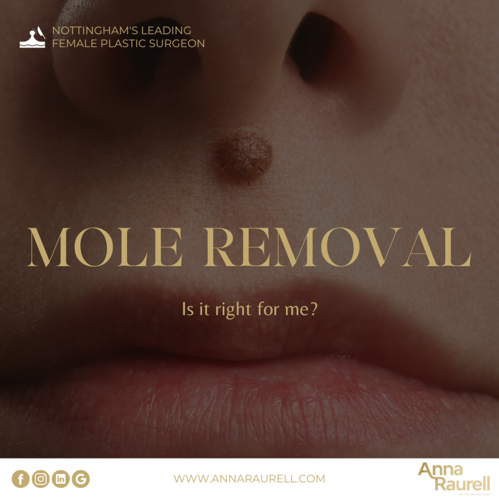 mole removal - anna raurell