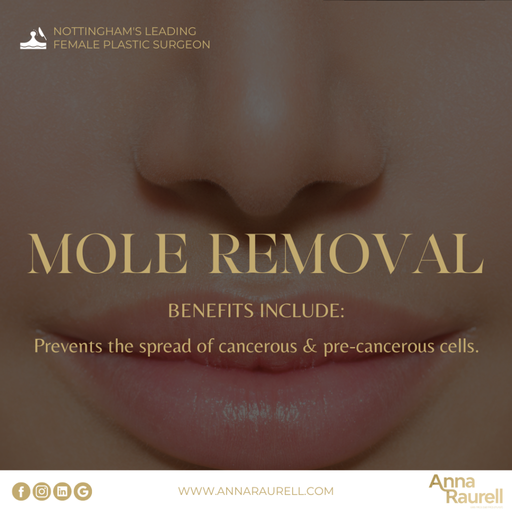mole removal post operative - anna raurell