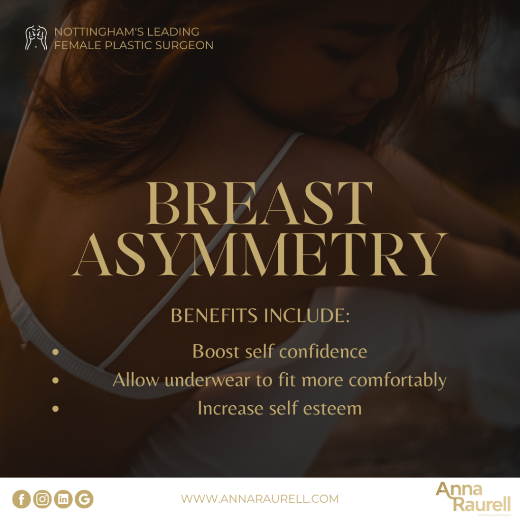 Breast asymmetry post operative -Anna Raurell - Cosmetic Surgery