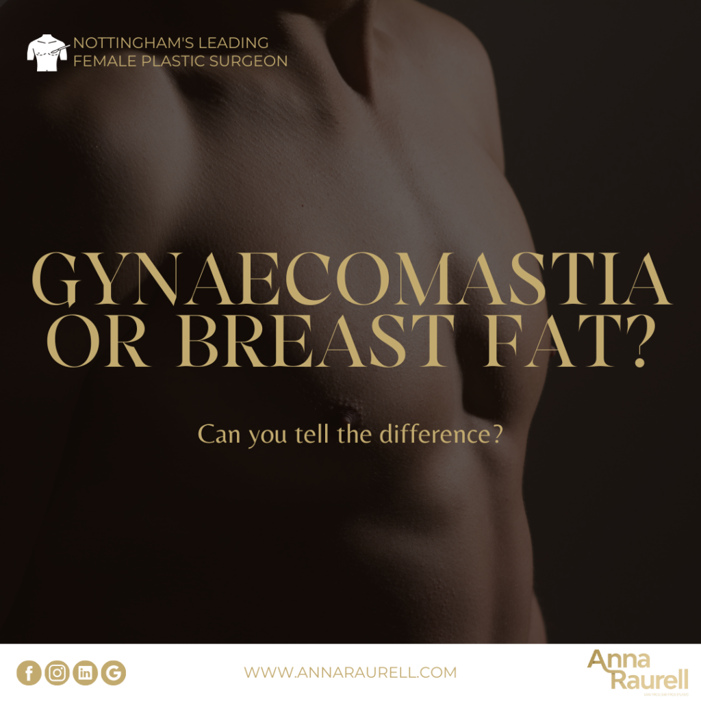 Breast fat or gynaecomastia? - Anna Raurell - Cosmetic Surgery