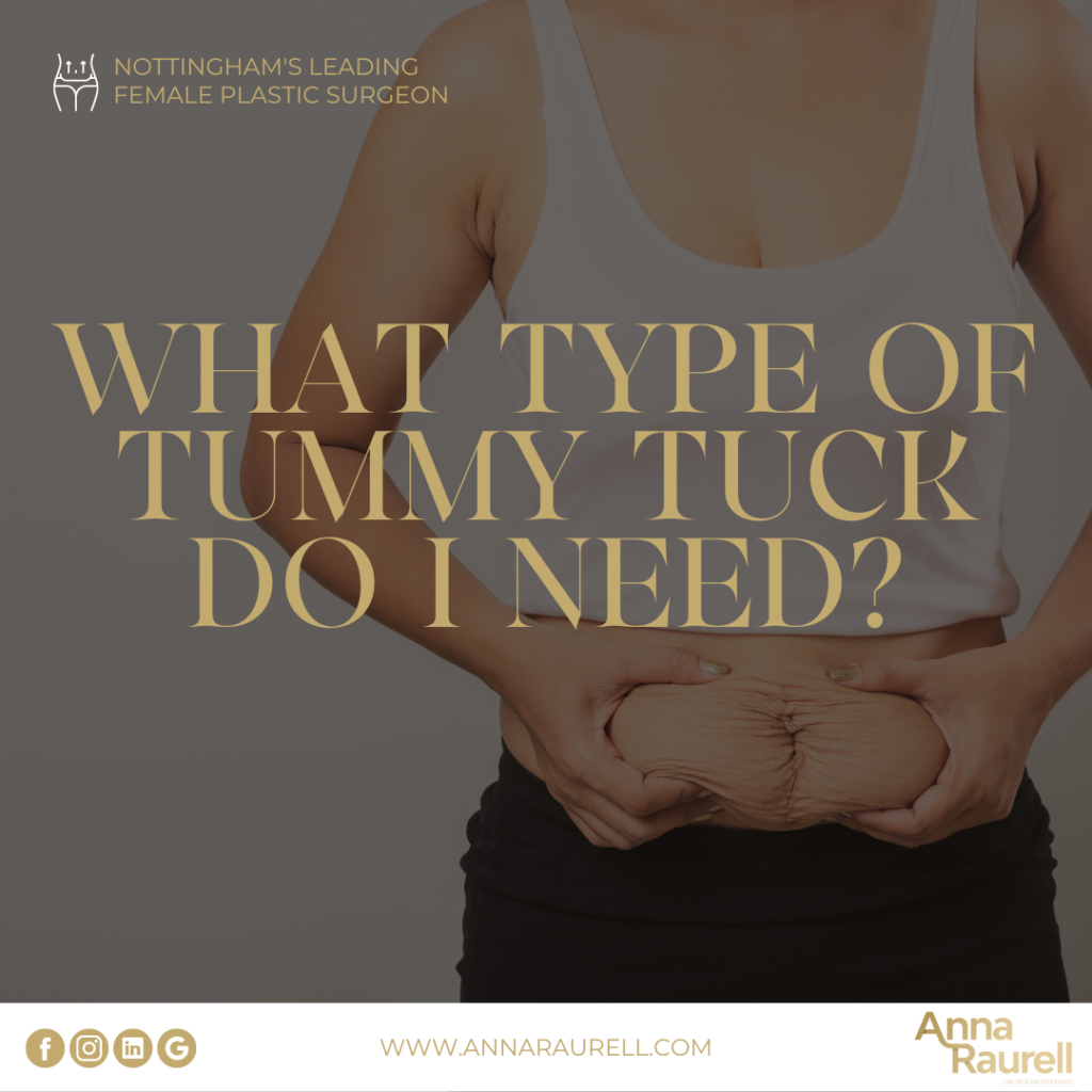 What type of tummy tuck do I need? - Anna Raurell