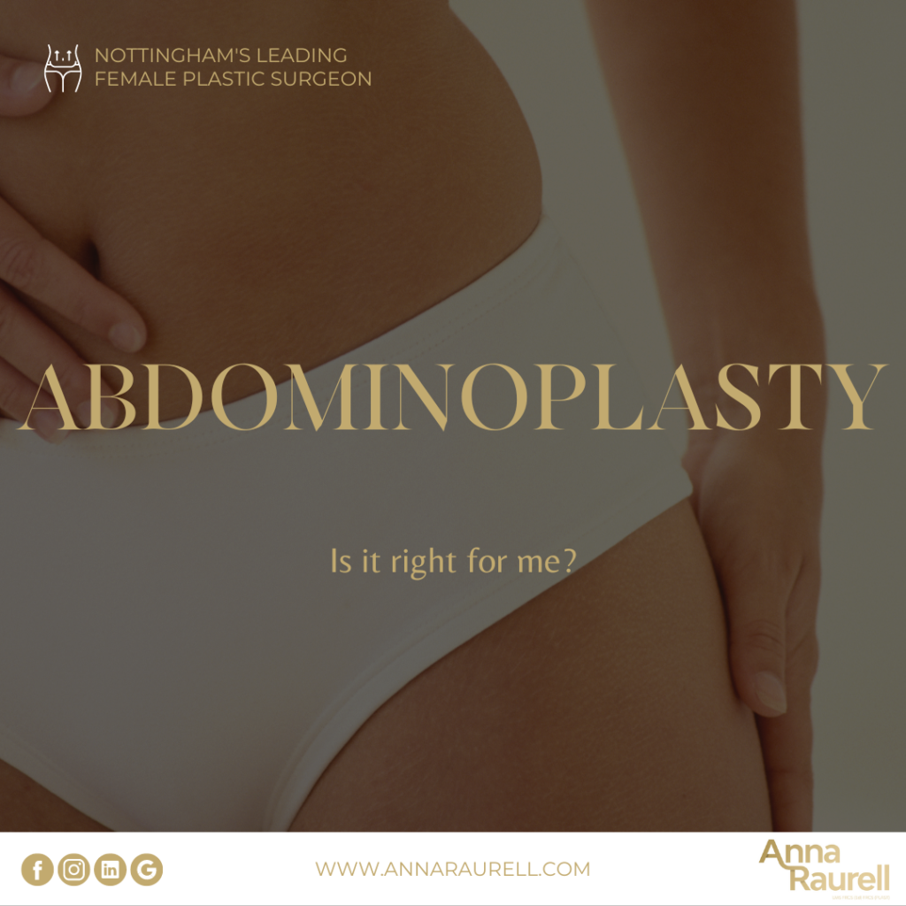 Abdominoplasty - your questions answered - Anna Raurell