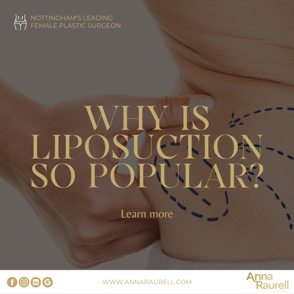 Why is liposuction so popular? - Anna Raurell - Cosmetic Surgery