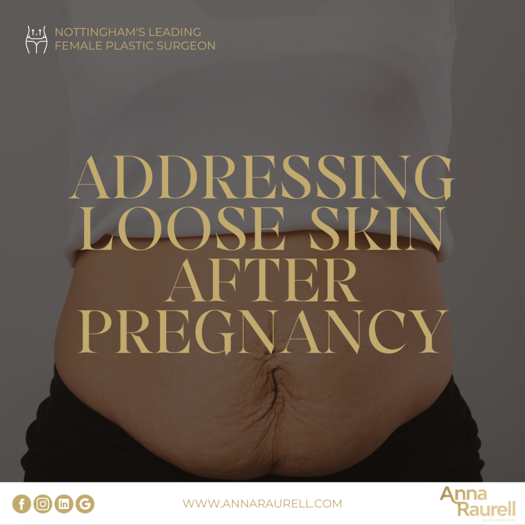 Addressing loose skin after pregnancy - Anna Raurell